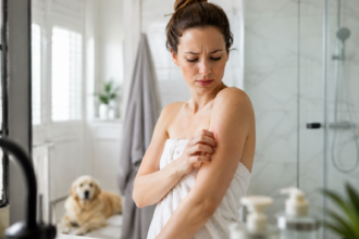 Frau steht nach dem Duschen im Badezimmer und betrachtet besorgt eine juckende Hautstelle am Arm, während ein Hund im Hintergrund liegt.
